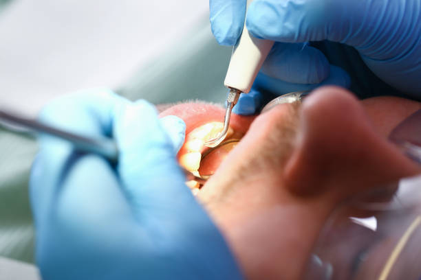 Best Broken or Cracked Tooth Emergency Dentist in Belpre, OH