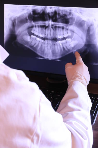Best Emergency Dentist for Lost Fillings or Crowns in Belpre, OH