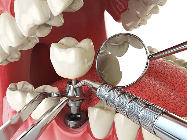 Best Emergency Cosmetic Dentistry in Belpre, OH